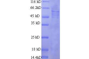 SDS-PAGE (SDS) image for Protein S (PROS) (AA 42-675) protein (His tag) (ABIN7585700)