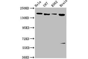 Western Blot Positive WB detected in: Hela whole cell lysate, U87 whole cell lysate, K562 whole cell lysate, Rat brain tissue All lanes: LIFR antibody at 3. (LIFR 抗体  (AA 915-1086))