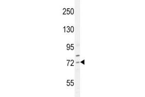 Western Blotting (WB) image for anti-Sterol Regulatory Element Binding Transcription Factor 2 (SREBF2) (AA 399-427) antibody (ABIN3032752)
