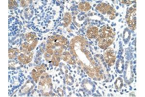 FAH antibody was used for immunohistochemistry at a concentration of 4-8 ug/ml to stain Epithelial cells of renal tubule (arrows) in Human Kidney. (FAH 抗体)