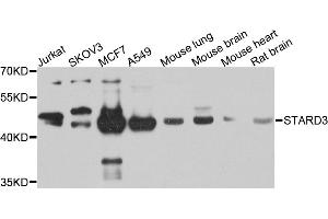 Western blot analysis of extracts of various cell lines, using STARD3 antibody. (STARD3 抗体)