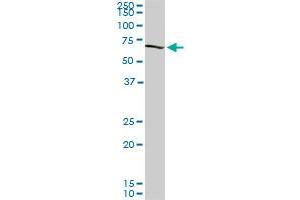 CROT monoclonal antibody (M01), clone 1A6. (CROT 抗体  (AA 2-99))
