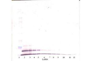 Image no. 3 for anti-Growth Regulated Oncogene gamma (GRO gamma) antibody (ABIN465909) (GRO gamma 抗体)