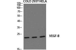 Western Blot (WB) analysis of specific cells using VEGF-B Polyclonal Antibody. (VEGFB 抗体  (Internal Region))