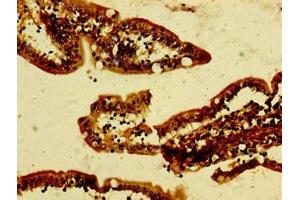 Immunohistochemistry of paraffin-embedded human small intestine tissue using ABIN7144231 at dilution of 1:100 (ANKRD49 抗体  (AA 4-239))
