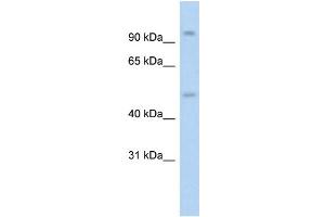 Western Blotting (WB) image for anti-Nuclear Receptor Subfamily 3, Group C, Member 1 (Glucocorticoid Receptor) (NR3C1) (N-Term) antibody (ABIN2777208)