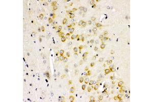 Anti- GRIA2 antibody, IHC(P) IHC(P): Rat Brain Tissue (GRIA2 抗体  (AA 25-360))