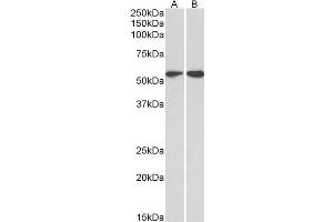 ABIN2613493 (2µg/ml) staining of HeLa (A) and Jurkat (B) lysates (35µg protein in RIPA buffer). (Vimentin 抗体  (C-Term))
