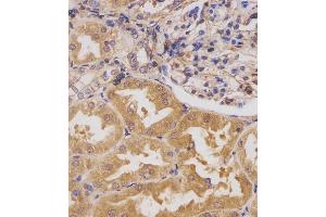 (ABIN391779 and ABIN2841638) staining HIPK3 in human kidney tissue sections by Immunohistochemistry (IHC-P - paraformaldehyde-fixed, paraffin-embedded sections). (HIPK3 抗体  (C-Term))