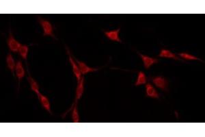 ABIN6275163 staining Hela by IF/ICC. (GIDRP88 抗体  (C-Term))