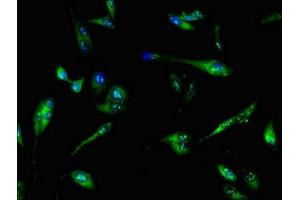 Immunofluorescent analysis of Hela cells using ABIN7144950 at dilution of 1:100 and Alexa Fluor 488-congugated AffiniPure Goat Anti-Rabbit IgG(H+L) (PFKL 抗体  (AA 229-479))
