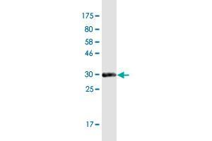 Western Blot detection against Immunogen (33. (RNF170 抗体  (AA 121-193))