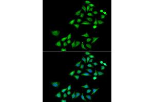 Immunofluorescence analysis of A549 cell using KLK4 antibody. (Kallikrein 4 抗体)