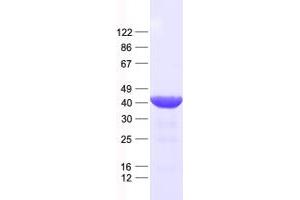 Western Blotting (WB) image for Distal-Less Homeobox Protein 2 (DLX2) protein (His tag) (ABIN2719526)