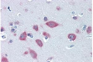 Human Brain, Cortex: Formalin-Fixed, Paraffin-Embedded (FFPE) (FARSB 抗体  (AA 234-342))