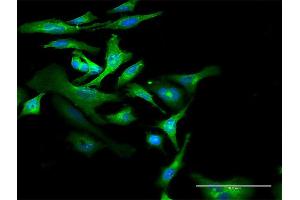 Immunofluorescence of purified MaxPab antibody to CD59 on HeLa cell. (CD59 抗体  (AA 1-128))