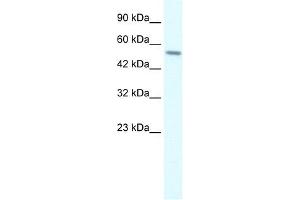 RGS6 antibody used at 2 ug/ml to detect target protein. (RGS6 抗体  (C-Term))