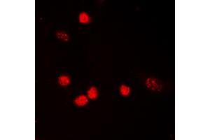 Immunofluorescent analysis of p53 (AcK319) staining in HeLa cells. (p53 抗体  (acLys319, C-Term))