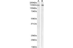 Western Blotting (WB) image for anti-phospholipase A2 Receptor 1, 180kDa (PLA2R1) antibody (ABIN5932307) (PLA2R1 抗体)