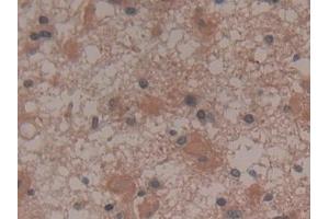 Immunohistochemistry (IHC) image for anti-Glycyl-tRNA Synthetase (GARS) (AA 567-735) antibody (ABIN7435301)