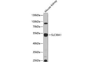 Western blot analysis of extracts of mouse kidney, using SLC30 antibody (ABIN6134927, ABIN6147967, ABIN6147970 and ABIN6225290) at 1:1000 dilution. (SLC30A1 抗体  (AA 250-350))