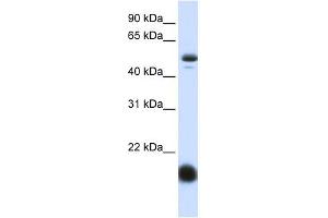 SLC22A7 antibody used at 1 ug/ml to detect target protein. (SLC22A7 抗体)