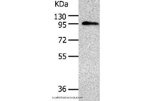 Western blot analysis of Human liver cancer tissue, using AKAP8 Polyclonal Antibody at dilution of 1:500 (AKAP8 抗体)