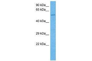 Western Blotting (WB) image for anti-General Transcription Factor IIH, Polypeptide 1, 62kDa (GTF2H1) (N-Term) antibody (ABIN2792595)