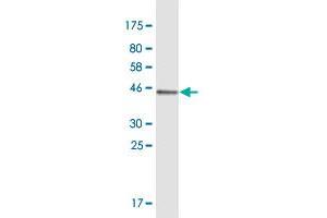 Western Blot detection against Immunogen (40. (Msx2/Hox8 抗体  (AA 1-133))