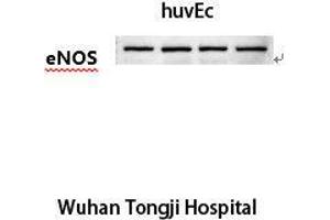 Western Blot (WB) analysis: Please contact us for more details. (ENOS 抗体)