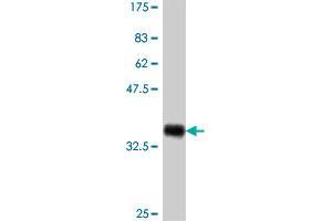 Western Blot detection against Immunogen (37. (PPM1F 抗体  (AA 1-100))