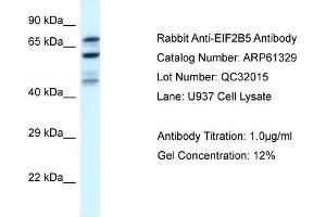 Western Blotting (WB) image for anti-Eukaryotic Translation Initiation Factor 2B, Subunit 5 Epsilon, 82kDa (EIF2B5) (N-Term) antibody (ABIN2788769) (EIF2B5 抗体  (N-Term))
