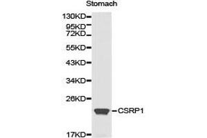 Western Blotting (WB) image for anti-Cysteine and Glycine-Rich Protein 1 (CSRP1) antibody (ABIN1872045) (CSRP1 抗体)