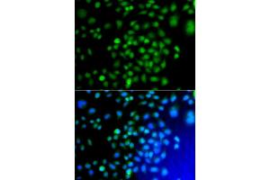 Immunofluorescence analysis of A549 cell using ATF7 antibody. (AFT7 抗体)