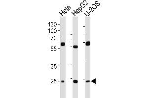 Western blot analysis of lysates from Hela, HepG2, U-2OS cell line (from left to right), using TFAM Antibody at 1:1000 at each lane. (TFAM 抗体  (C-Term))