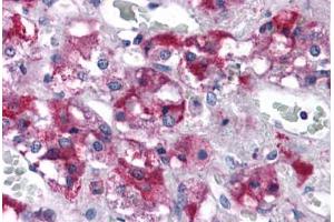 Human Adrenal: Formalin-Fixed, Paraffin-Embedded (FFPE) (RIMS2 抗体  (C-Term))