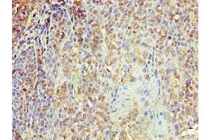 Immunohistochemistry of paraffin-embedded human tonsil tissue using ABIN7156126 at dilution of 1:100 (KPNA1 抗体  (AA 8-538))