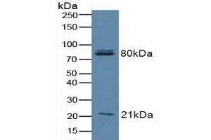 Detection of BAD in Human A549 Cells using Polyclonal Antibody to Bcl2 Associated Death Promoter (BAD) (BAD 抗体  (AA 1-168))