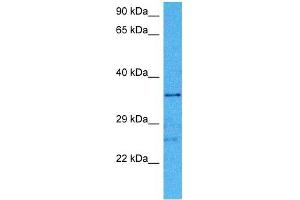 Host:  Mouse  Target Name:  HIF1AN  Sample Tissue:  Mouse Brain  Antibody Dilution:  1ug/ml (HIF1AN 抗体  (Middle Region))
