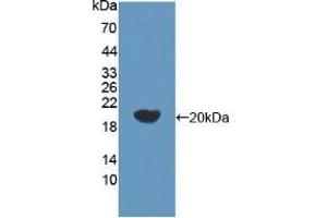 Detection of Recombinant bACE2, Human using Polyclonal Antibody to Beta Secretase 2 (BACE2) (BACE2 抗体  (AA 230-396))