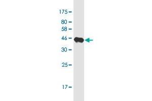 Western Blot detection against Immunogen (37. (PCDH11X 抗体  (AA 1228-1336))