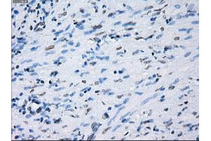 Immunohistochemical staining of paraffin-embedded Ovary tissue using anti-PSMA7mouse monoclonal antibody. (PSMA7 抗体)