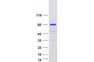 UPF3B Protein (Transcript Variant 2) (Myc-DYKDDDDK Tag)