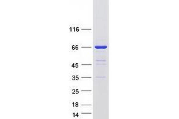 UPF3B Protein (Transcript Variant 2) (Myc-DYKDDDDK Tag)