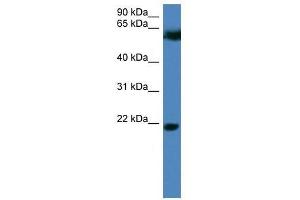 Western Blot showing FBXO32 antibody used at a concentration of 1-2 ug/ml to detect its target protein.