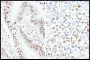 anti-Splicing Factor, Arginine/Serine Rich 7 (SFRS7) (AA 75-125) antibody