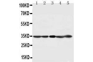 Anti-CDK1 antibody, Western blotting Lane 1: HELA Cell Lysate Lane 2: 293T Cell Lysate Lane 3: A431 Cell Lysate Lane 4: CEM Cell Lysate Lane 5: JURKAT Cell Lysate