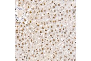 Immunohistochemistry of paraffin-embedded rat liver using Phospho-Smad2-S465/467 + Smad3-S423/425 Rabbit pAb (ABIN6135314, ABIN6136248, ABIN6136249 and ABIN6225575) at dilution of 1:50 (40x lens). (SMAD2 / SMAD3 (pSer423), (pSer425) 抗体)