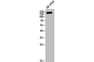 Western Blotting (WB) image for anti-Collagen, Type IV, alpha 2 (COL4A2) (N-Term) antibody (ABIN7188645)