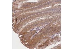 Immunohistochemical staining of human stomach with TMEM39A polyclonal antibody  shows moderate cytoplasmic positivity in glandular cells at 1:10-1:20 dilution. (TMEM39A 抗体)
